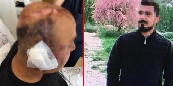 Polisi telsizle �ld�resiyle d�ven zanl�: Olay� hat�rlam�yorum