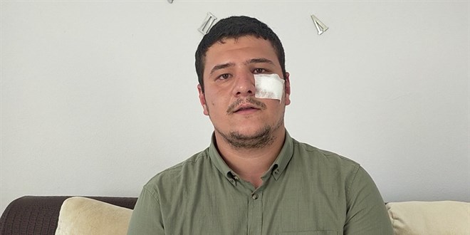 Saldırıya uğrayan İHA muhabiri Akşener'i yalanladı