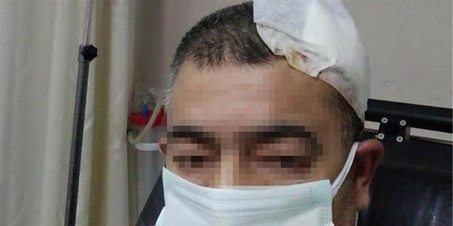 Amasya'da imam, müezzine tabureyle saldırdı