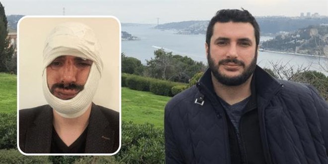 AA muhabirinin çenesini kıran magandalar serbest kaldı