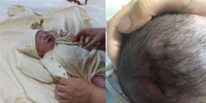 Bebek doum srasnda drld kafatas krld, personele soruturma