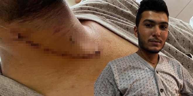 Şah damarı kesilen işçi 3 saatlik ameliyatla sağlığına kavuştu