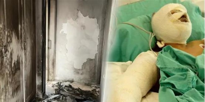 Damat dehşeti: Kayınvalidesini canlı canlı yaktı