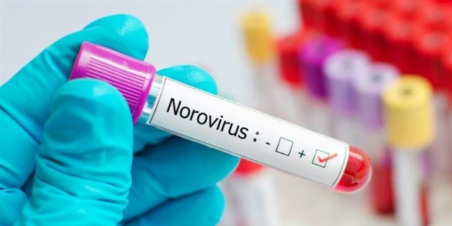 Yeni tehlike norovirüs: Bu belirtilere dikkat!