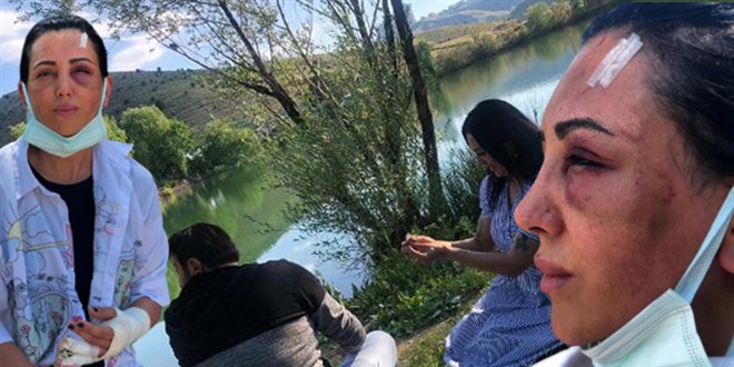 Spor eğitmeni kadın, eski sevgilisi tarafından darp edildi