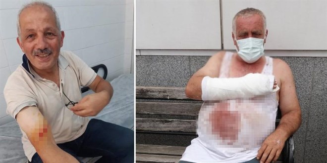 Trabzon'da, belediye bakan kurban keserken yaraland