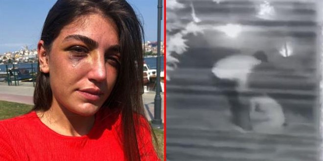 Ünlü mankeni öldüresiye döven eski sevgilisi tutuklandı