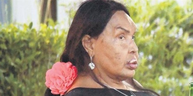 B�lent Ersoy'un makyajs�z hali