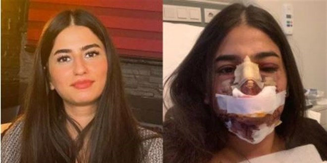 Rızası dışında estetik yaptı 'sana düğün hediyem olsun' dedi