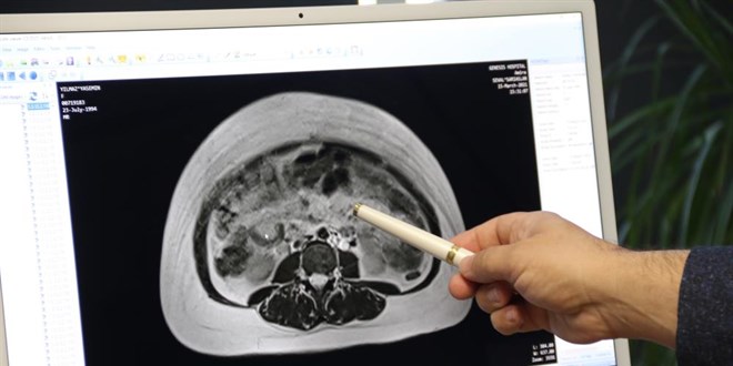 İngilizce öğretmeni yıllardır hamile gibi yaşıyordu, gerçeği doktorda öğrendi