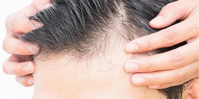 Merdiven altı yerler Avrupa'dan gelen hasta sayısını azaltıyor