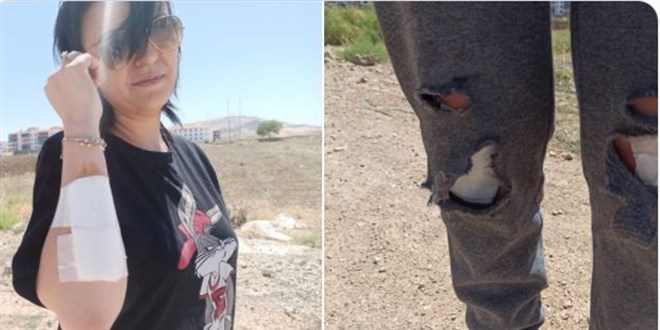 Başıboş köpeklerin saldırısına uğrayan kadın canının zor kurtardı