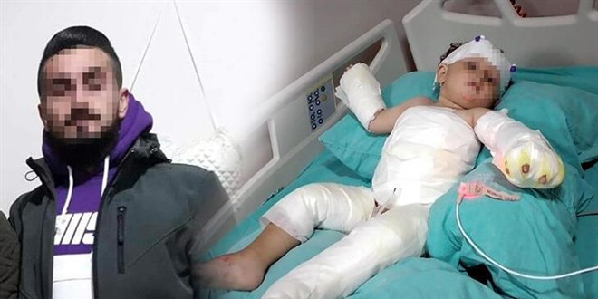 Eşi ve oğlunu kolonya dökerek yakan şüpheli tutuklandı