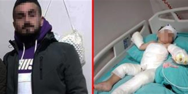 Kolonyalı vahşetin şüphelisi babadan ilginç ifade: Nasıl oldu bilmiyorum