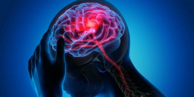 ABD'li uzmanlardan beyin hasarlarn tedavi edecek sistem