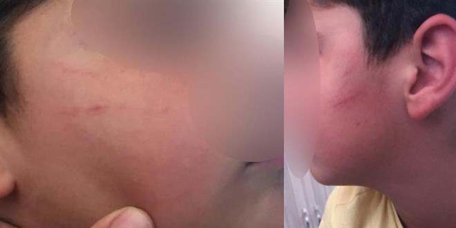 Aile, ilkokulda tokat atan öğretmenden şikayetçi oldu