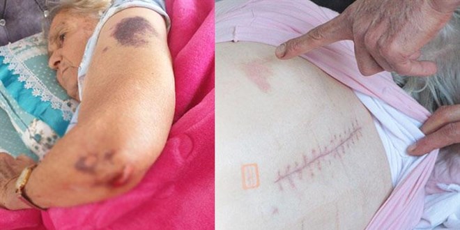 Yürüyerek girdiği hastaneden yatalak çıktı, darp edildiğini öne sürdü