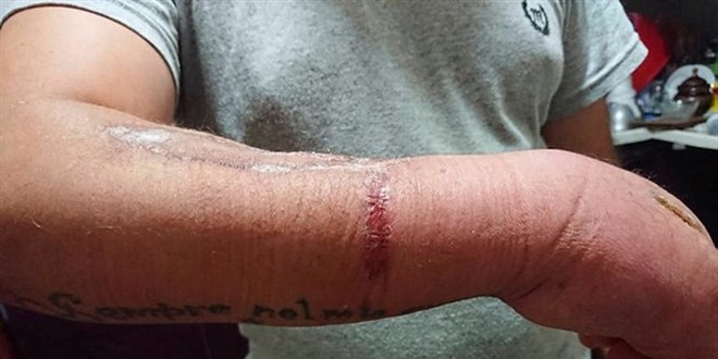 �ama��r suyu Hac� Ali Aydar'�n hayat�n� karartt�